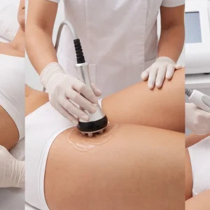 Tratamiento reductor liposlim